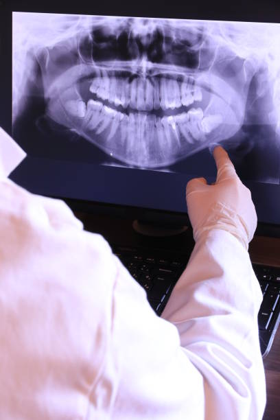 Urgent Tooth Repair in LA