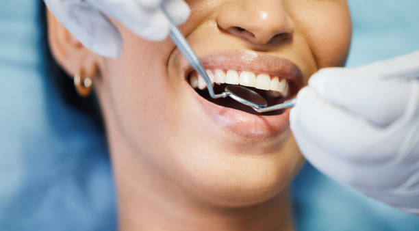 Emergency Dentist Open Today in LA
