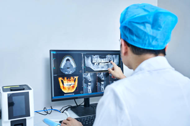 Emergency Dental Filling Replacement in LA